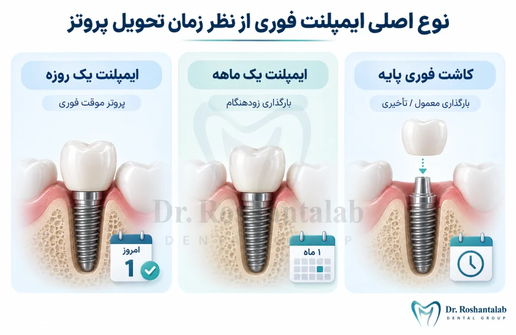 3 نوع اصلی ایمپلنت فوری از نظر زمان تحویل پروتز