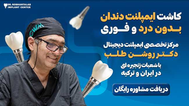 مرکز ایمپلنت دکتر روشن طلب