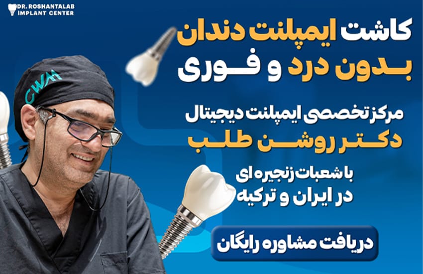 کاشت ایمپلنت دندان فوری