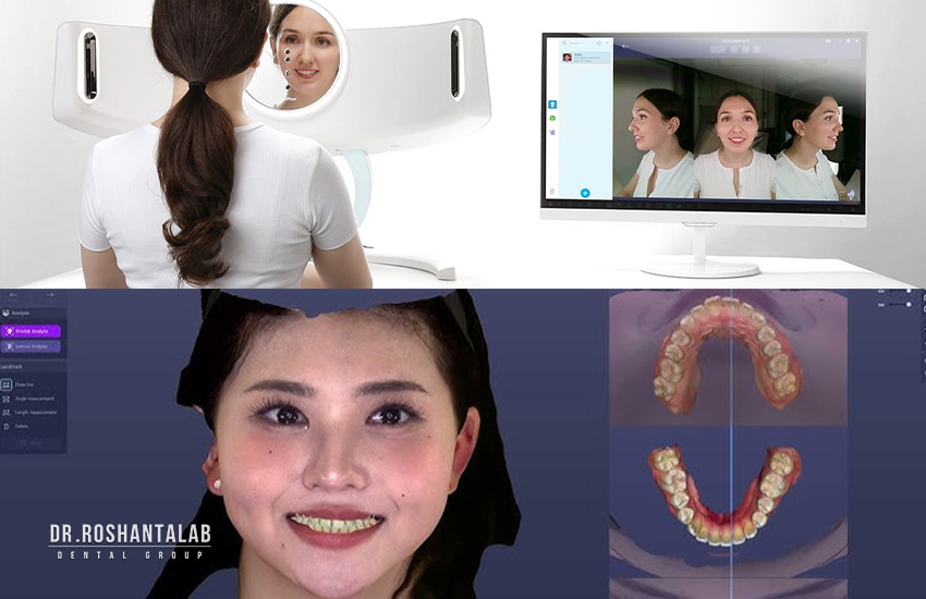 فیس اسکن: بهترین دکتر ایمپلنت دیجیتال در تهران