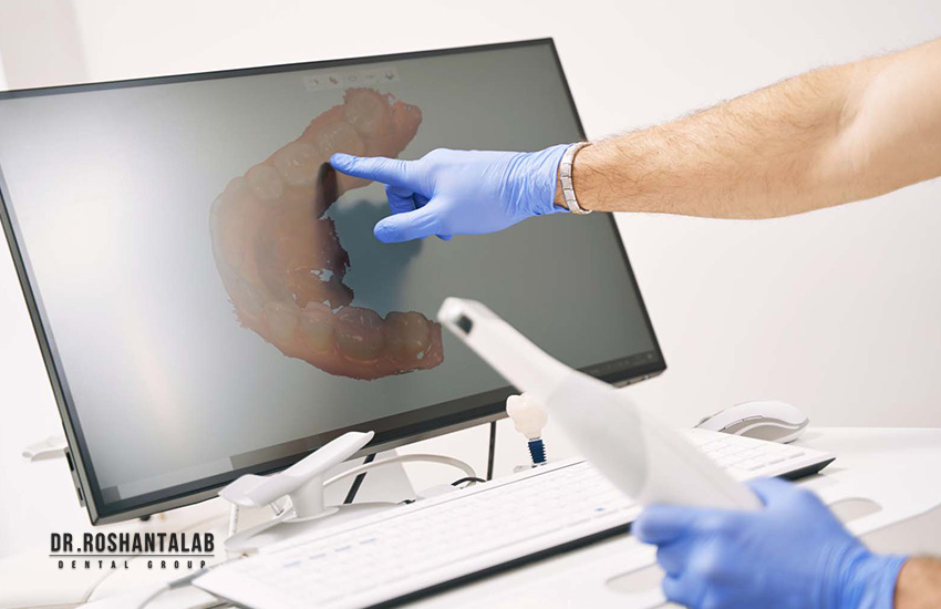 اسکنر دهانی برای قالب گیری در کلینیک دندانپزشکی پاسارگاد