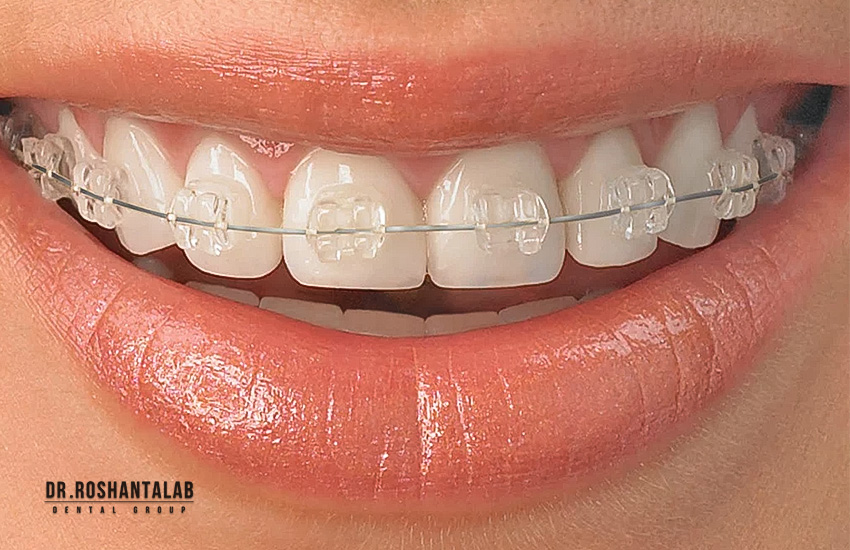 ارتودنسی دندان