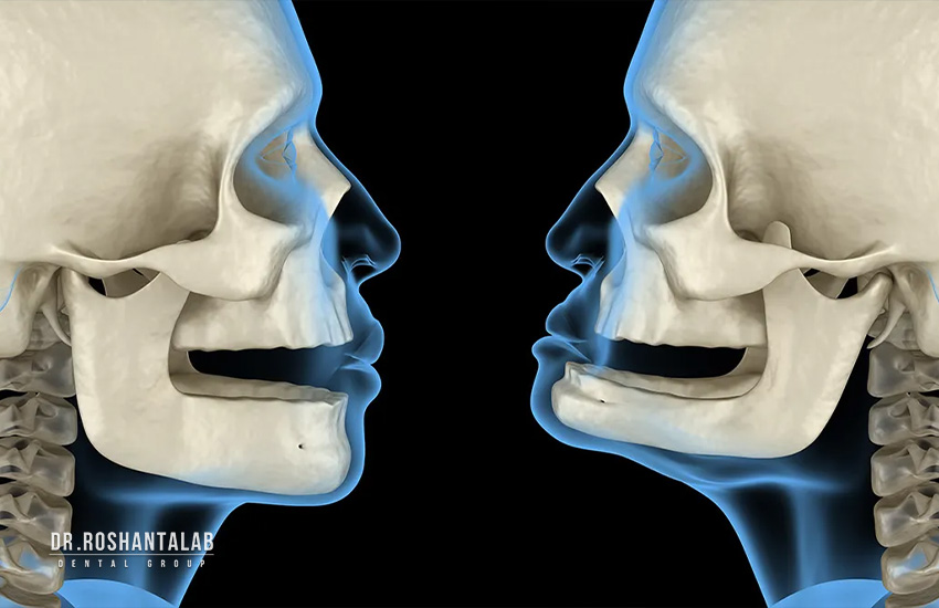 چرا فک دچار تحلیل استخوان می‌شود؟