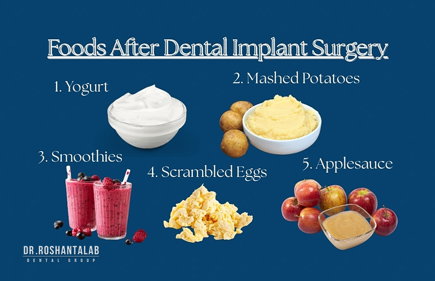 بعد از پیوند استخوان چه بخوریم؟