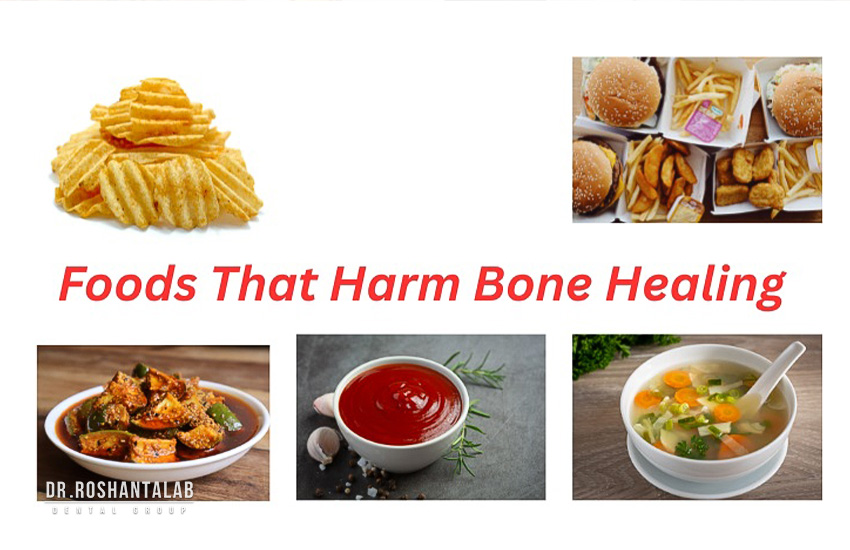 مراقبت‌های بعد از عمل پیوند استخوان