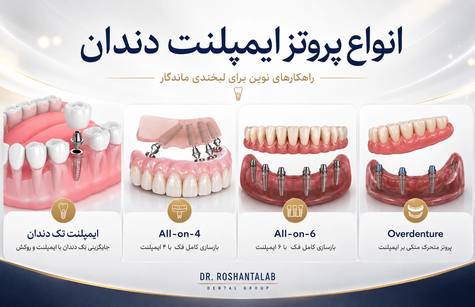 پروتز ایمپلنت دندان در 7 مرحله؛ انواع، ساخت و نصب