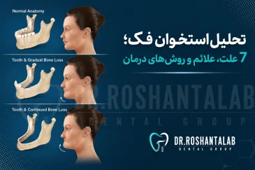 تحلیل استخوان فک؛ 7 علت، علائم و روش‌های درمان