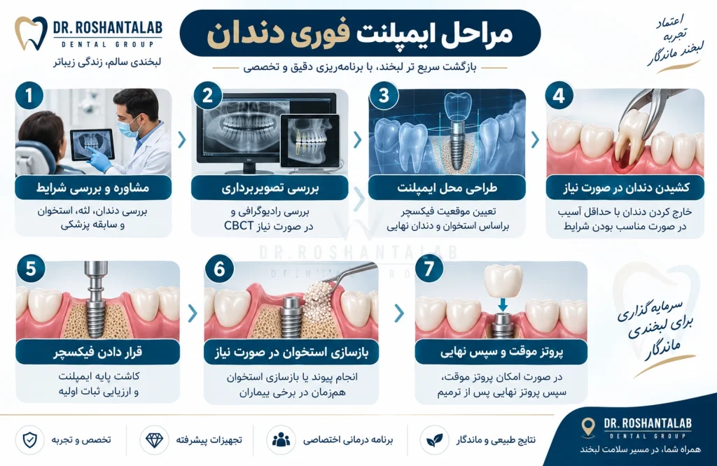 مراحل ایمپلنت فوری دندان